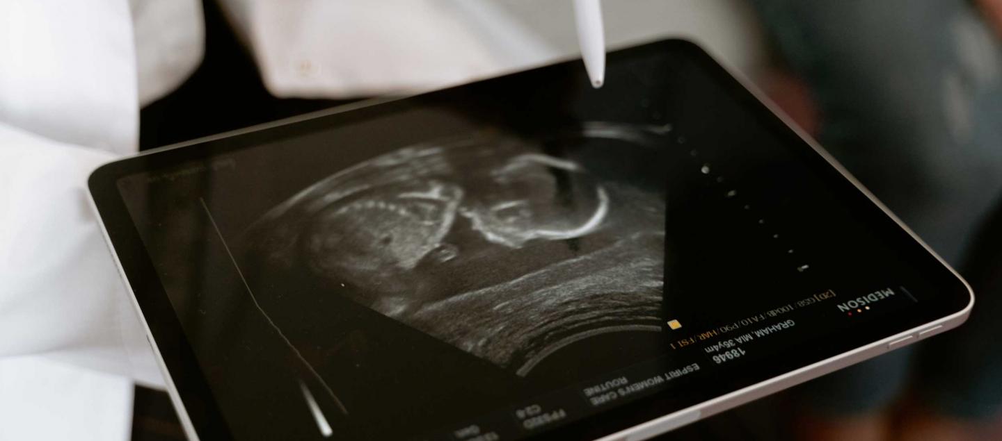 A closeup of a doctor pointing at a sonogram